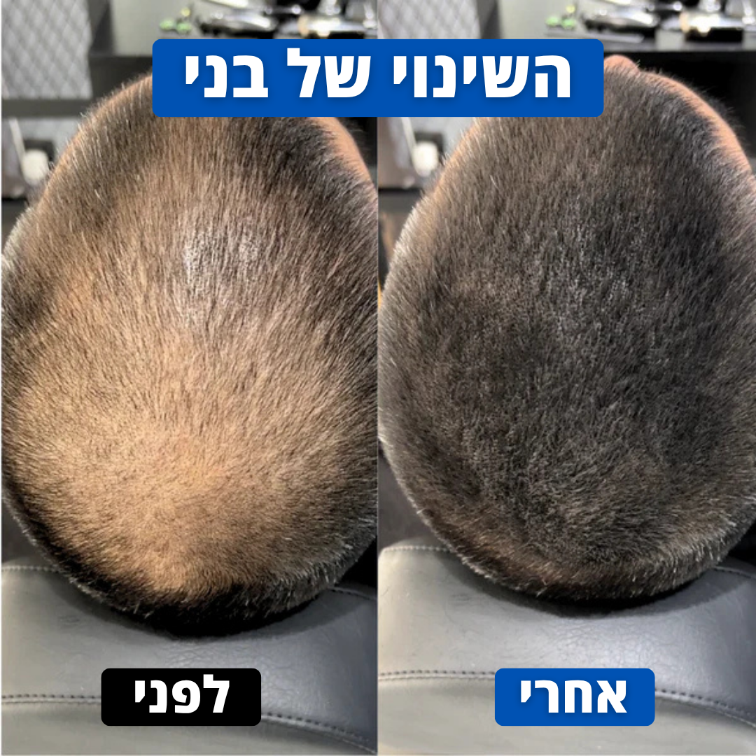 אבקת השיער של Hairly