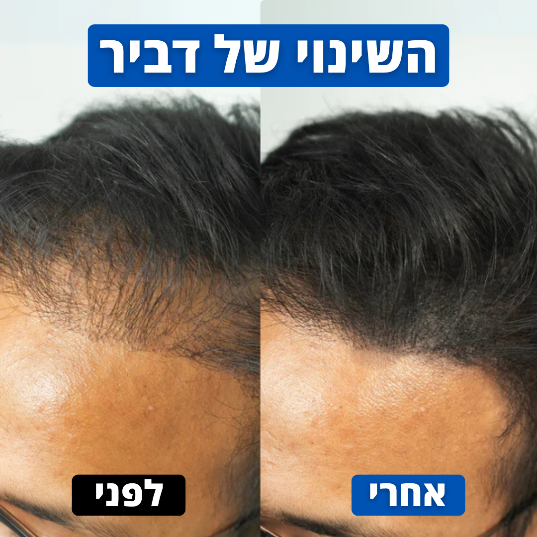 אבקת השיער של Hairly