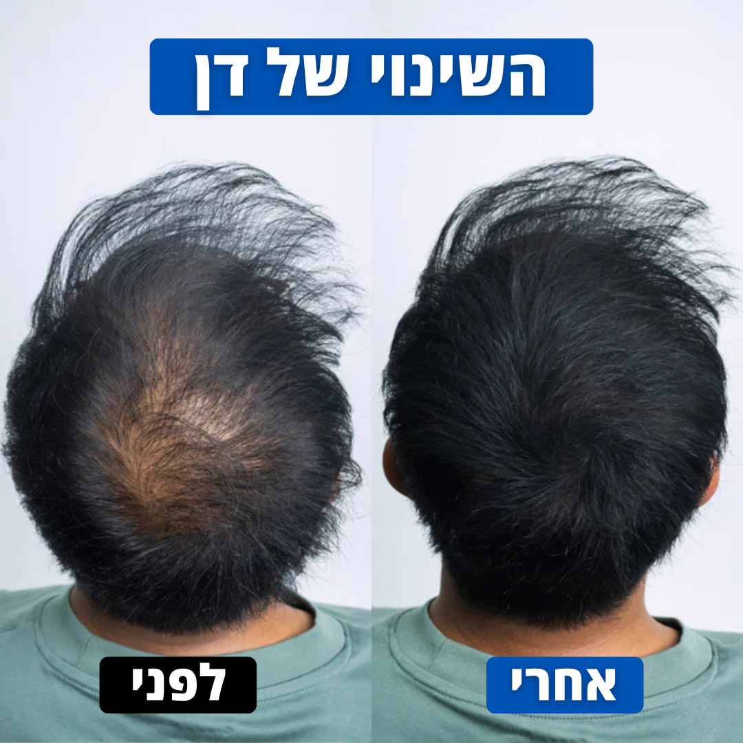 אבקת השיער של Hairly