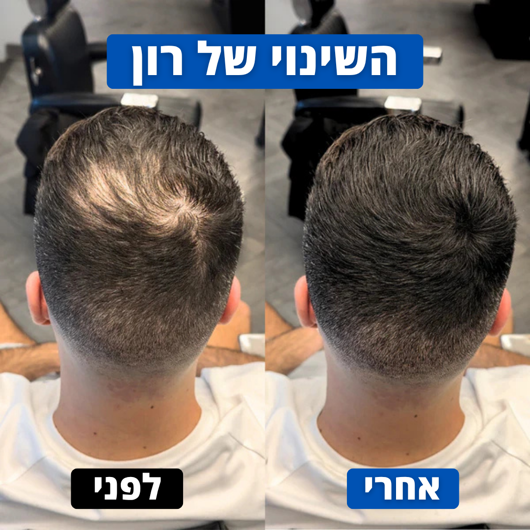 אבקת השיער של Hairly